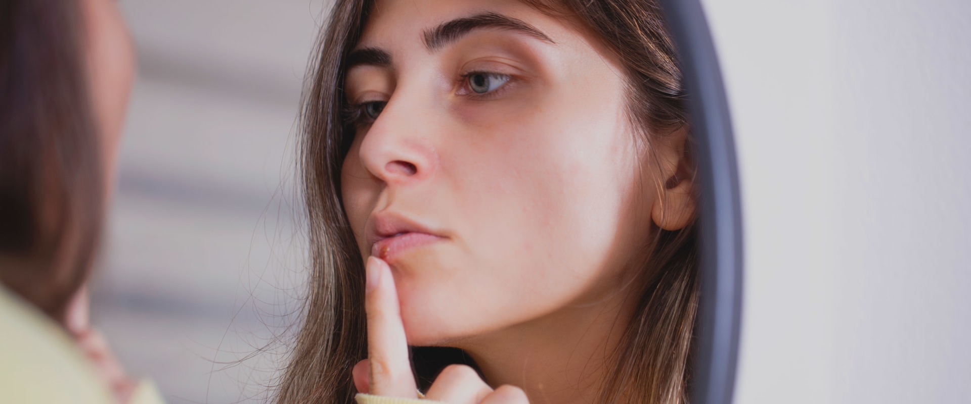 Acyclovir Tablets for Herpes An Overview